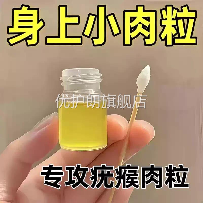 去猴子小肉粒疙瘩肉刺疣瘊子跖疣祛除膏神器扁平疣一抹无忧一抹灵