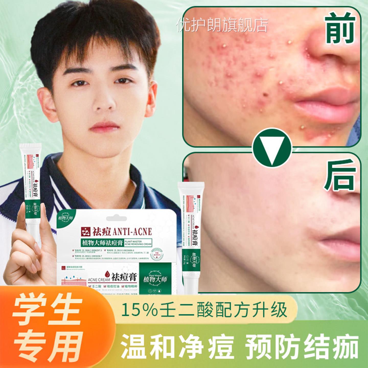 少青年痘膏痘去祛正品青春痘初中生女额头痤疮治脸上痘痘的药膏优