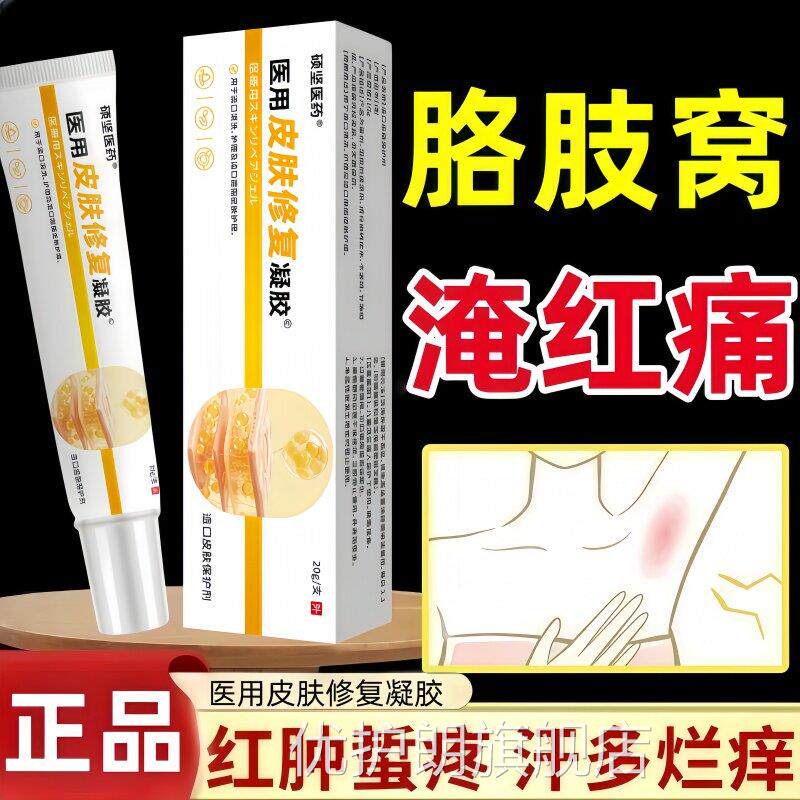 夏天腋窝淹红痛】男女腋窝痛腌红刺胳膊肉多出汗蛰腋下热毒湿疹膏