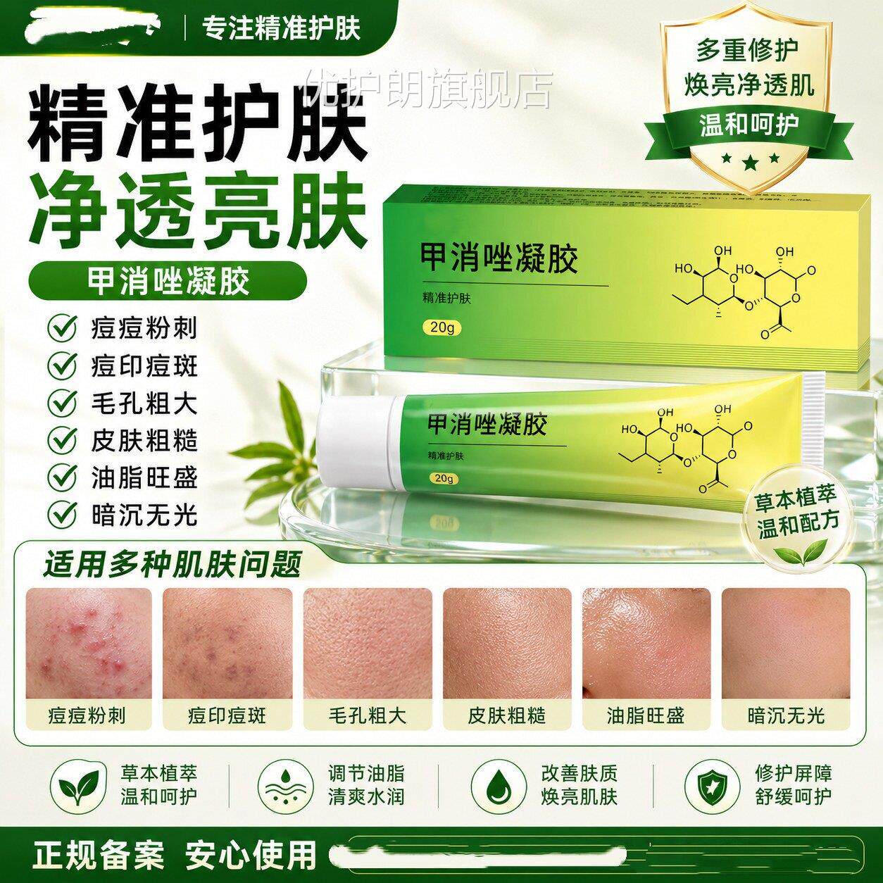 甲消硝唑凝胶正官方旗舰店软膏20g祛痘品印消焱红肿淡痤仓酒渣鼻