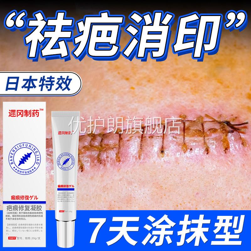 祛疤膏硅酮凝胶去疤痕修复除疤儿童烫伤增生凸起疤剖腹产祛疤优护