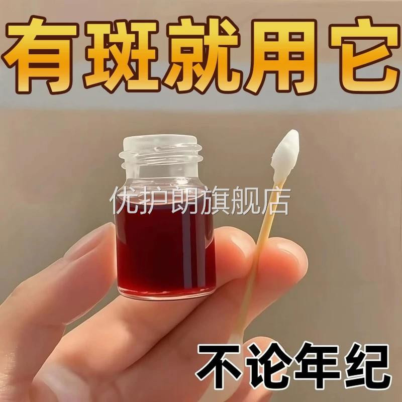 点志膏无痕药水美容院正品脸部去祛黑点雀斑老年斑不留疤美容金水