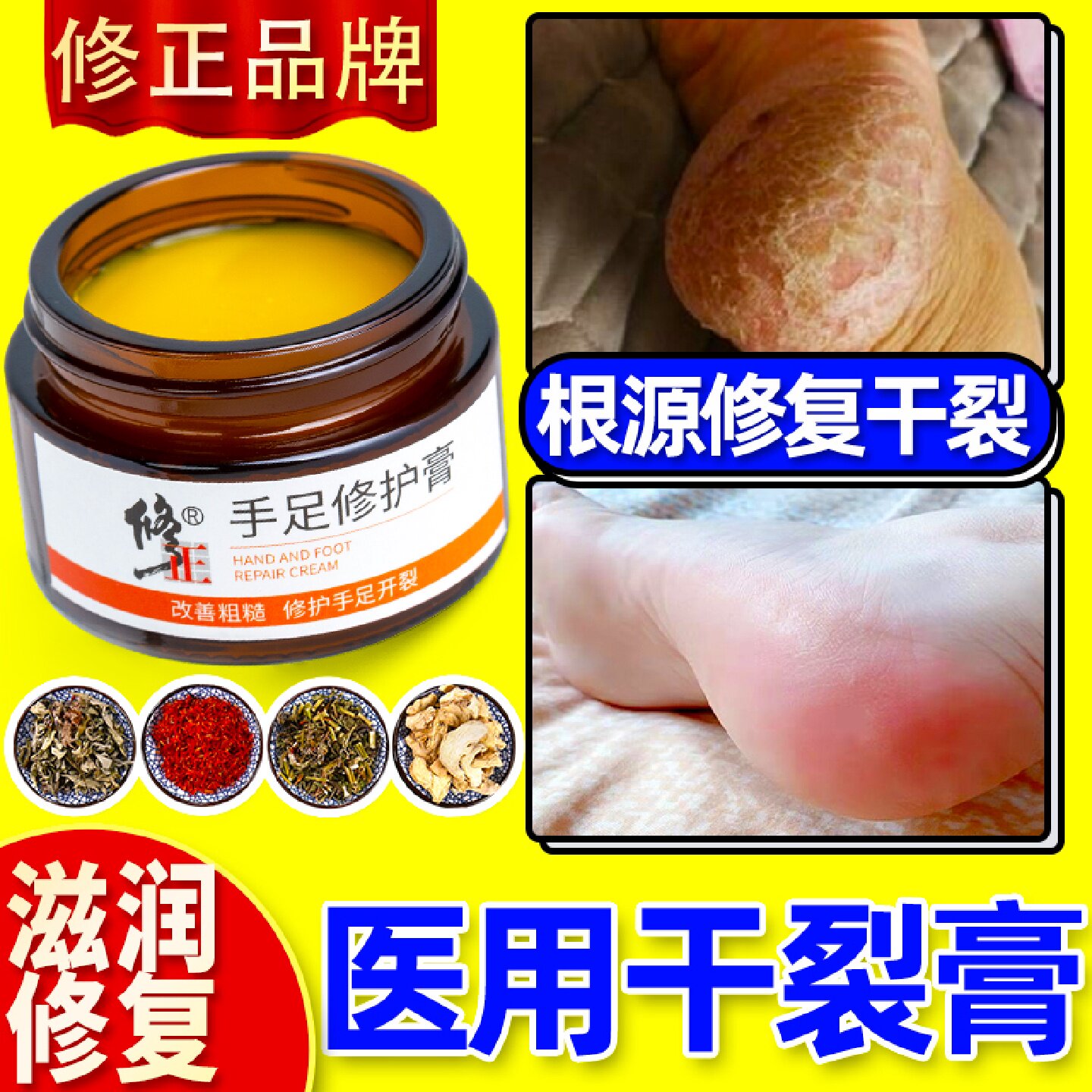 治脚后跟干裂修复霜防裂龟裂开裂底手足马油去死皮神器脱旗舰店