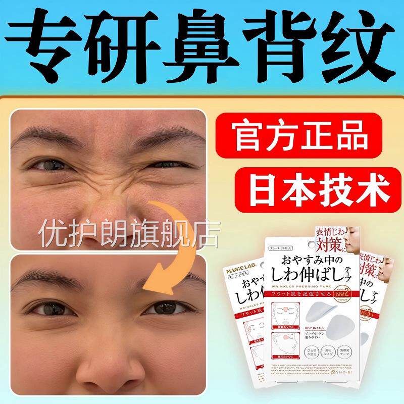 日本鼻梁皱纹贴背纹贴去除淡化消除祛横线鼻专用面部肌肉额川y优