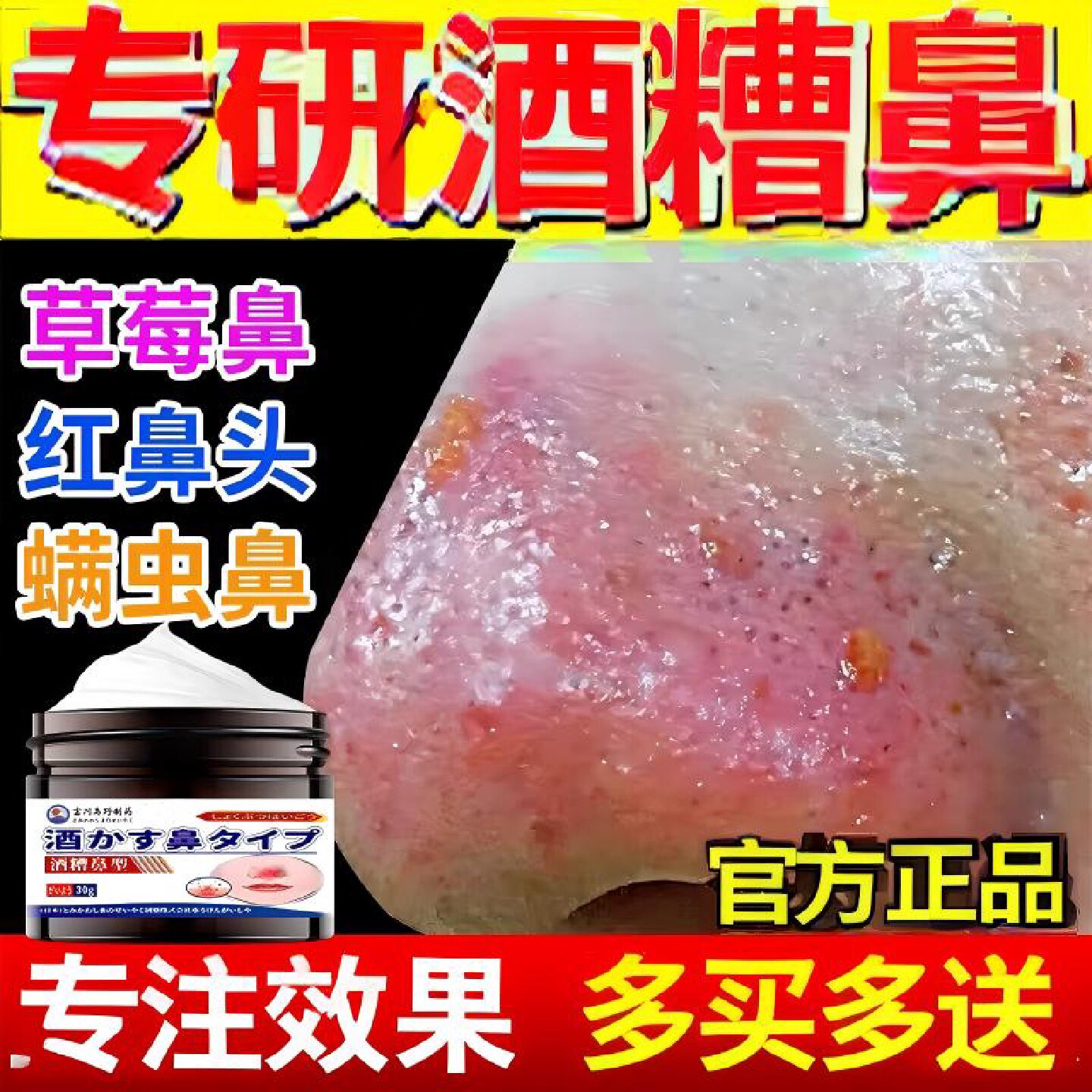 日本酒糟鼻膏草莓鼻修复鼻螨清去黑头除螨虫毛孔粗大痤疮膏旗舰店