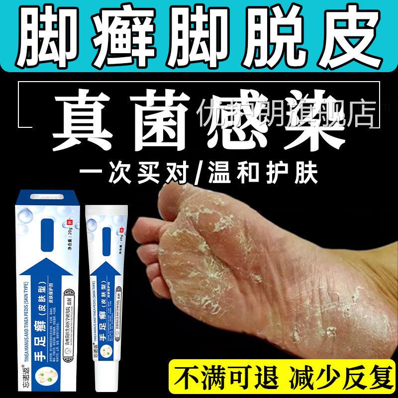 角化型足癣脚癣一次净官方旗舰店脚脱皮裂真菌感染贵州神干奇止UU