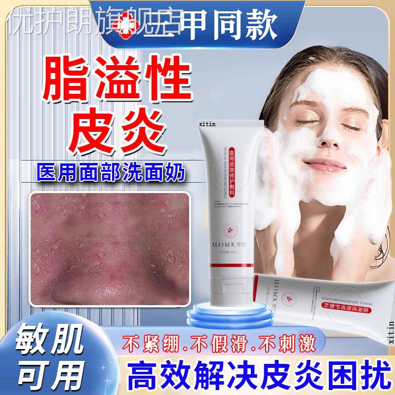 脂溢性皮炎洗面奶面部护肤品马拉色菌脂溢性皮炎鼻翼子两侧泛红GX