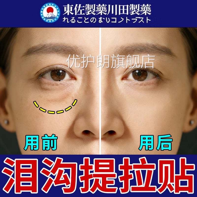 泪沟提拉贴日窝本进口神器眼凹i陷修复袋紧致抗皱淡化小熨斗正品