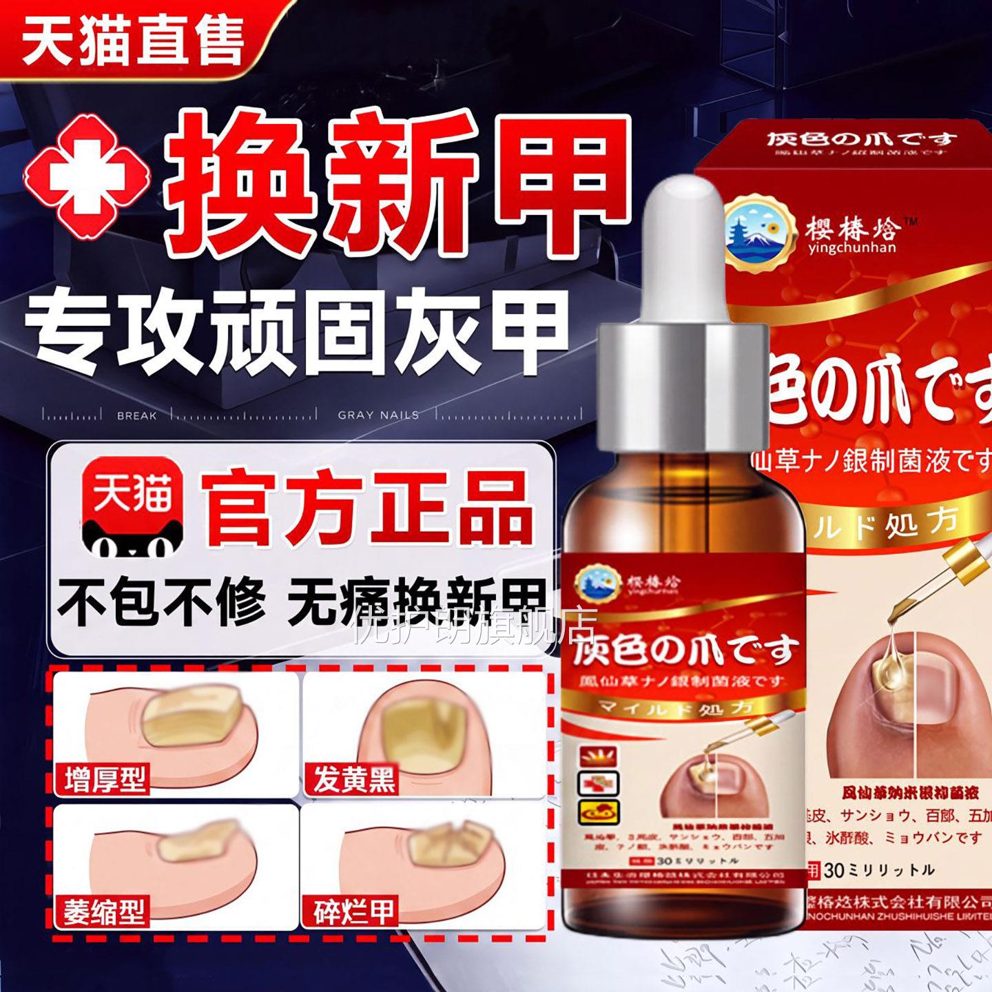 灰指甲凤仙花用药治疗灰指甲非本进口脱甲专抑菌日官方旗舰店正品