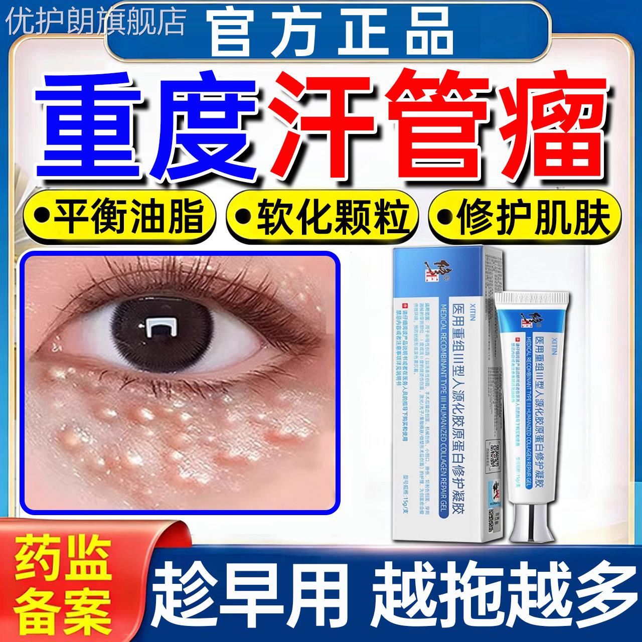 汗管瘤眼部去除神器脂肪粒扁平疣眼周消除小疙瘩专药膏用旗舰店PP
