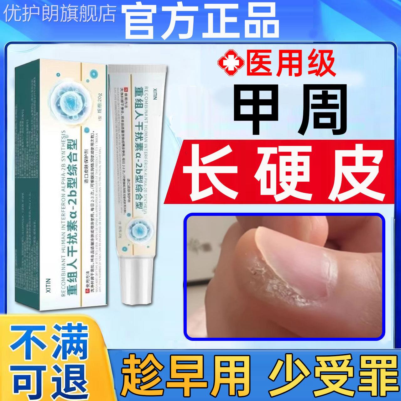 软化甲周硬皮去手指甲边缘死皮老硬茧去除角质变硬专用修复凝胶UU