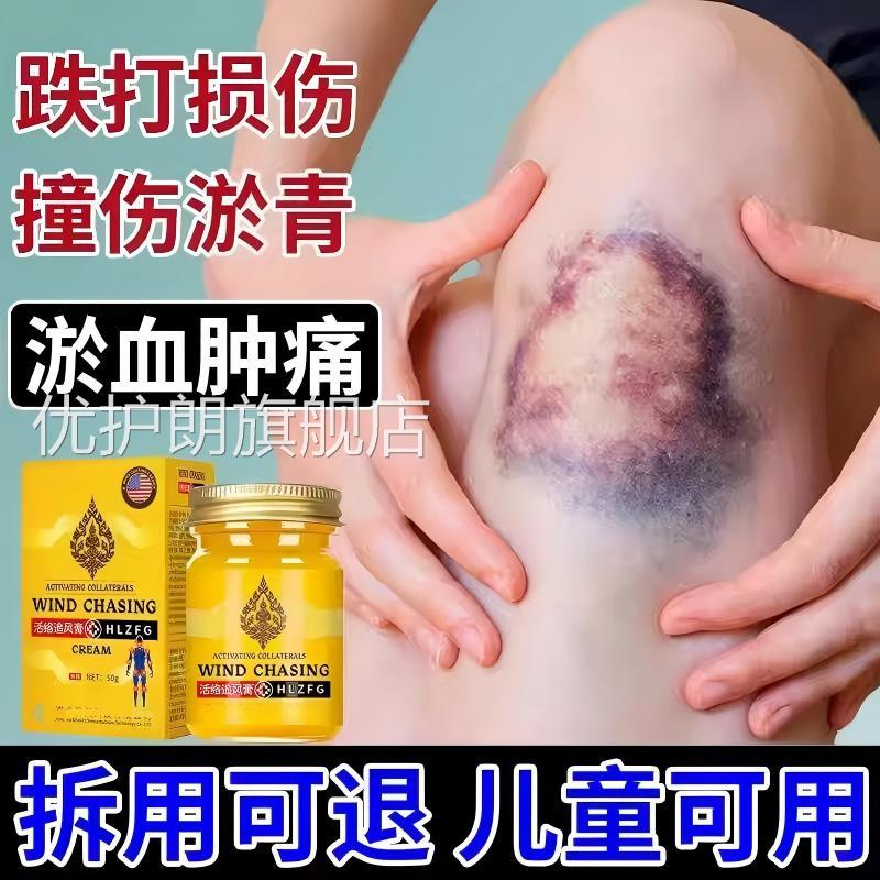 淤青快速消除活伤血化瘀膏婴儿童宝宝眼部脸上腿磕碰撞发紫外用优