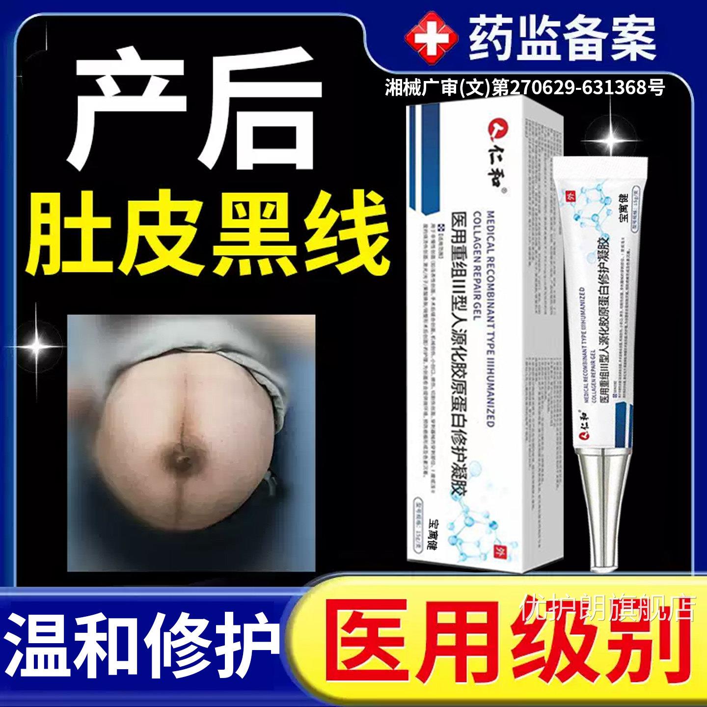 棘祛产后肚子黑色素沉淀去妊娠黑线腹部淡化黑皮纹皮肤白愈净乳膏