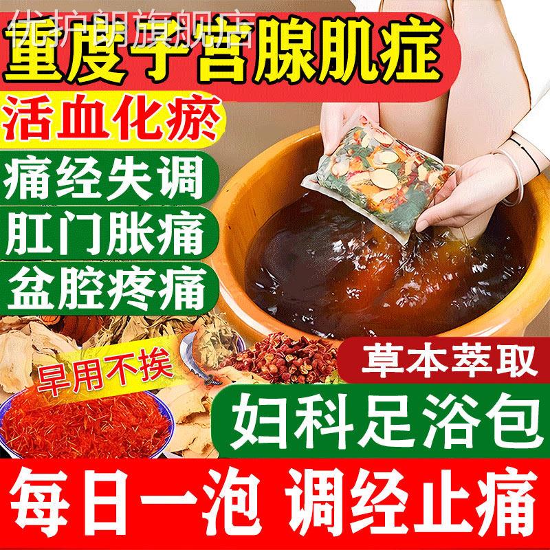 子宫腺肌症的药内膜异位宫寒痛经纤维肌瘤中药贴泡脚包调理盆腔GX