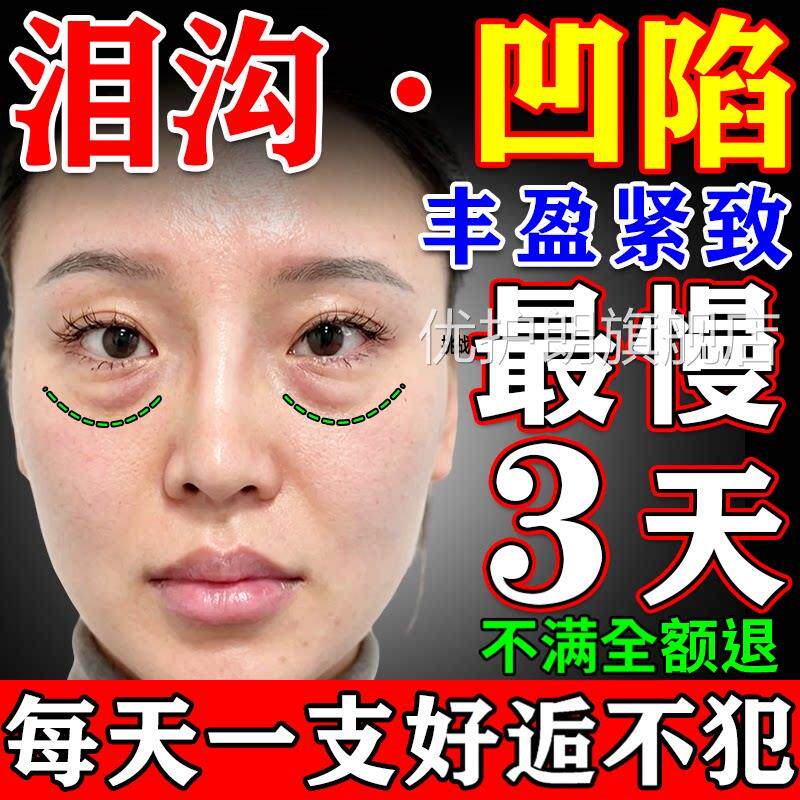泪沟填充神器眼凹窝陷修复胶原蛋白面部去除法令纹遮眼袋眼霜精华