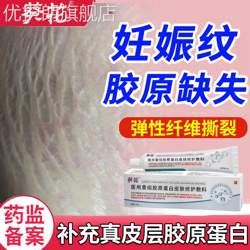 妊辰纹消除去妊娠纹紧致肚皮产后预防祛修复膏凝胶淡化疤痕除疤膏