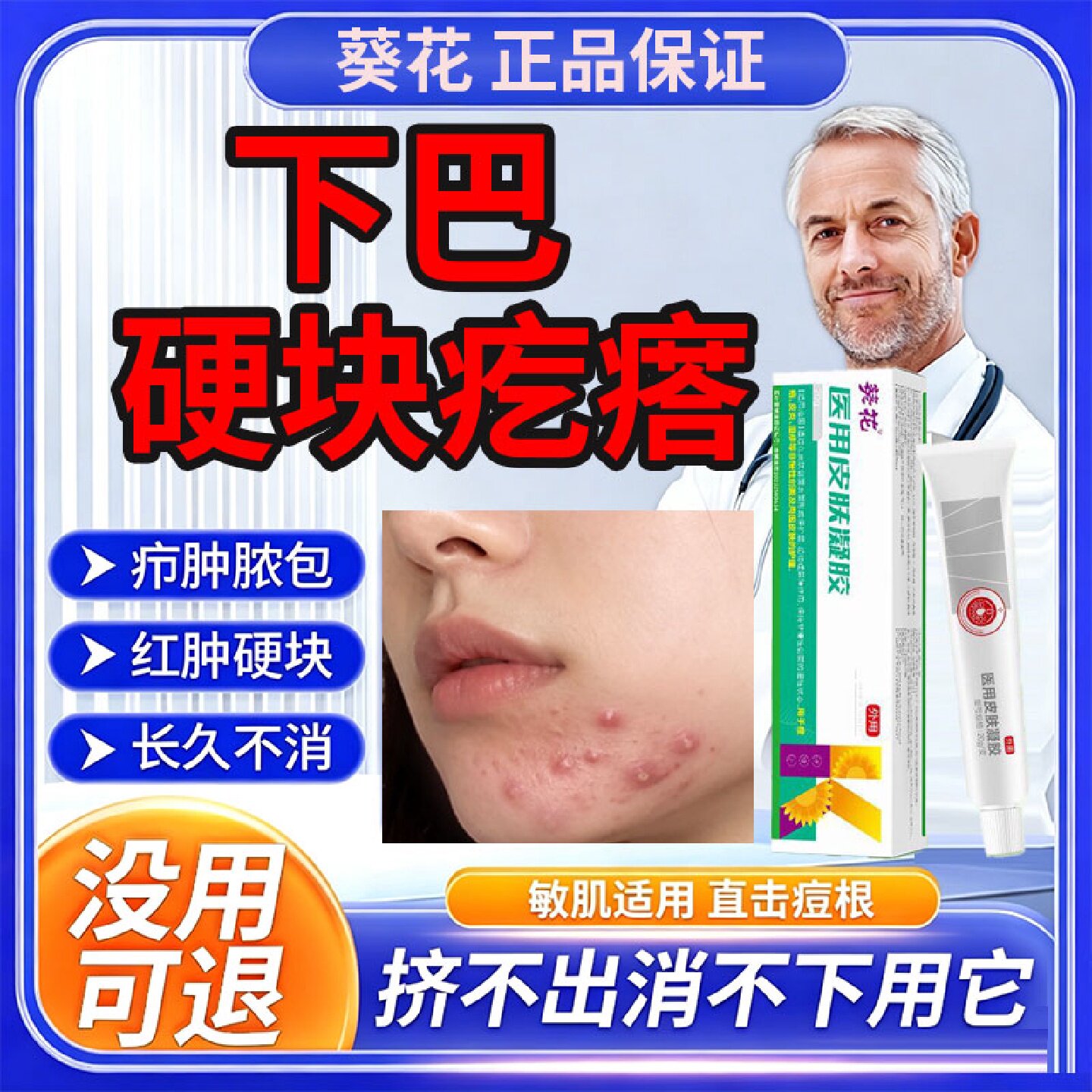 下巴反复长痘红肿硬块玫瑰痤疮屏障修复痘痘修复消炎痘印祛旗舰店
