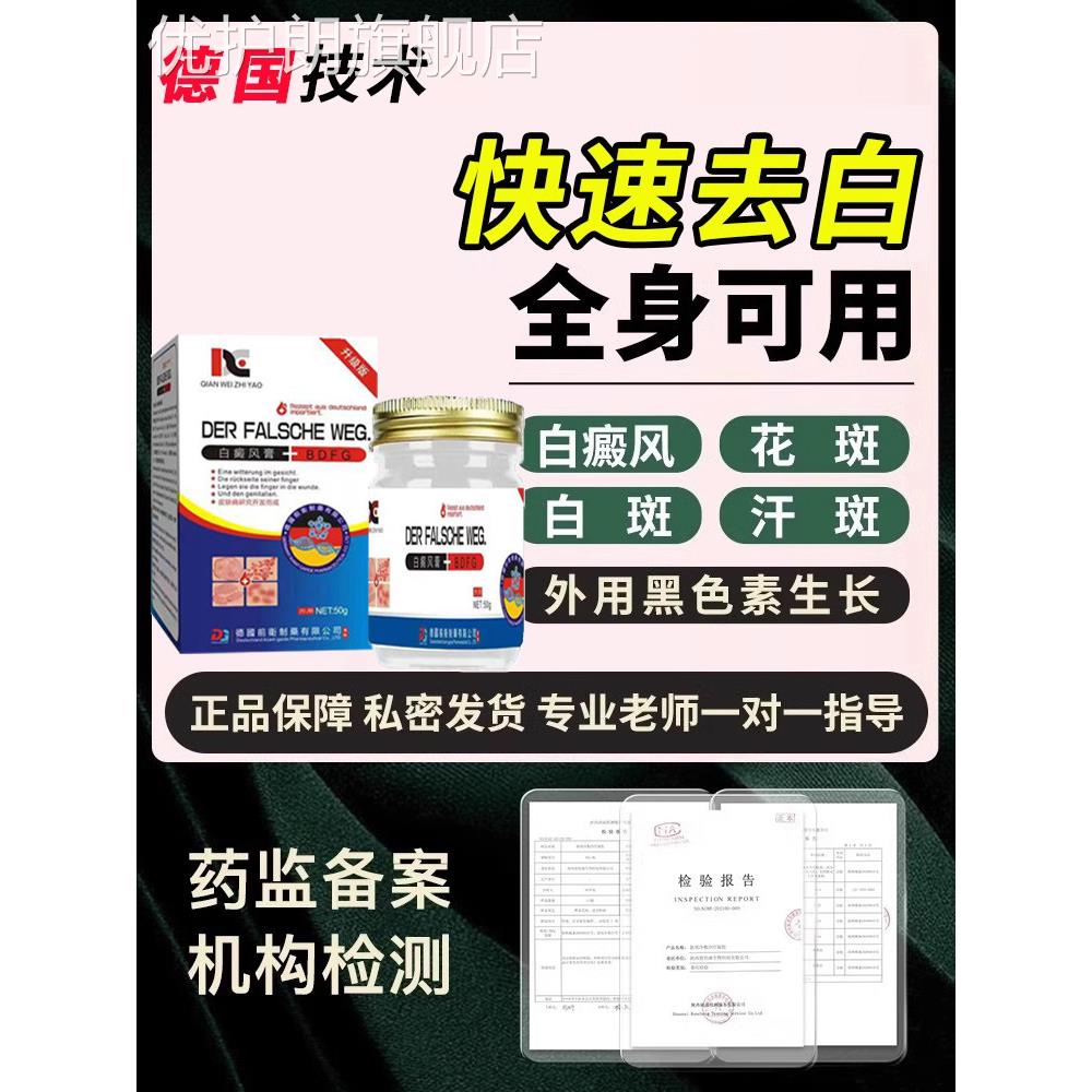 白癜风药膏快速消白斑黑色素增长308光疗仪伍德灯检测家用LL优护