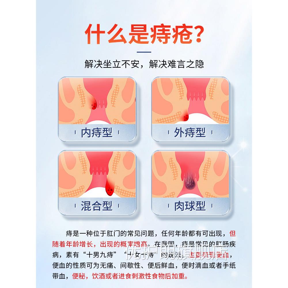 消痔疮敷凝胶官冷网痔疮膏卡波姆肛门消非根肉球断XW优护朗旗舰店