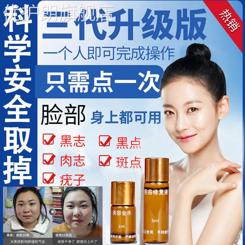点斑去痣点痣膏脸部专用除志去黑痣祛痣神器无痕正品美容院点痣水