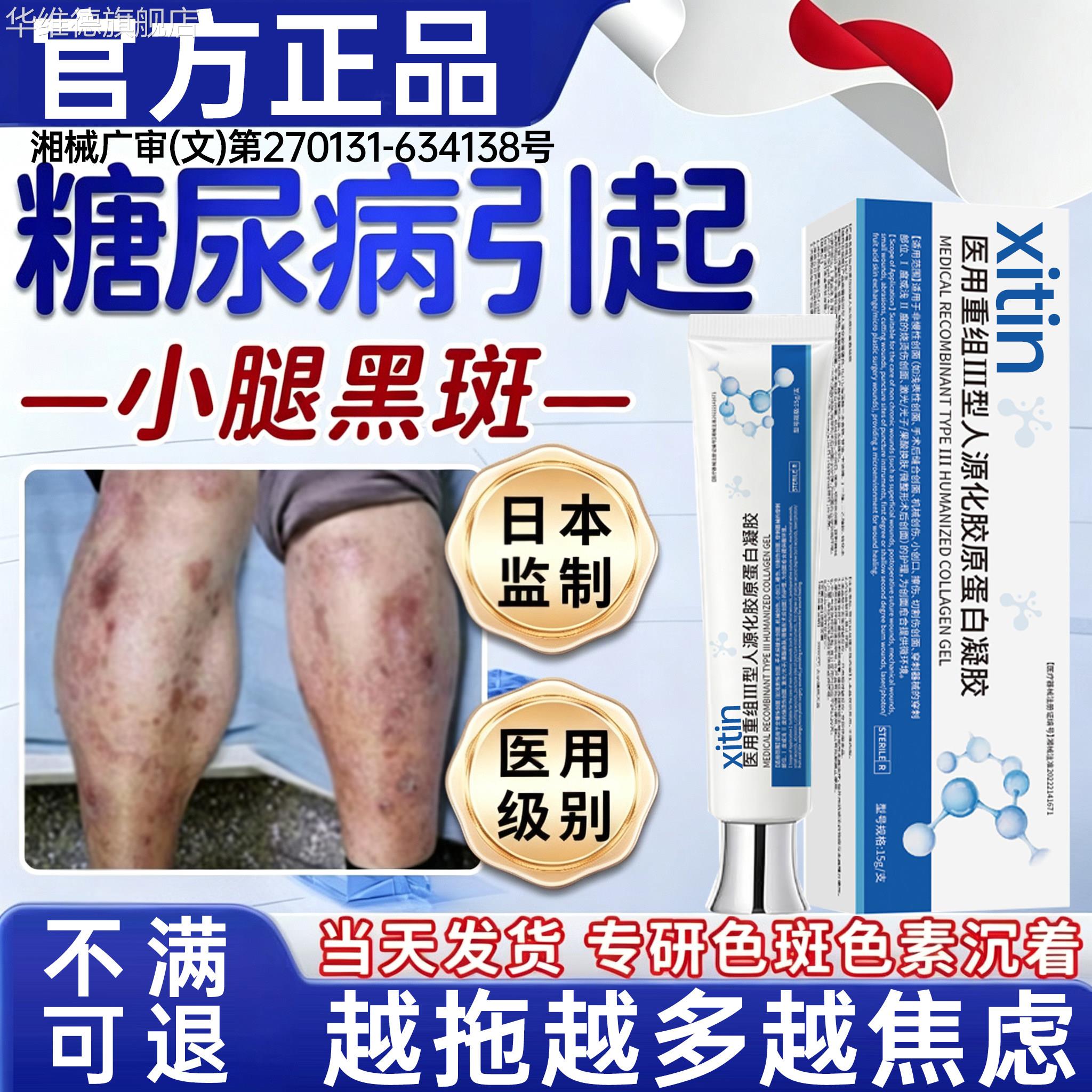 糖尿病引起小腿黑斑糖斑皮肤黑色素沉淀去除医用型胫前腿痒神经PP