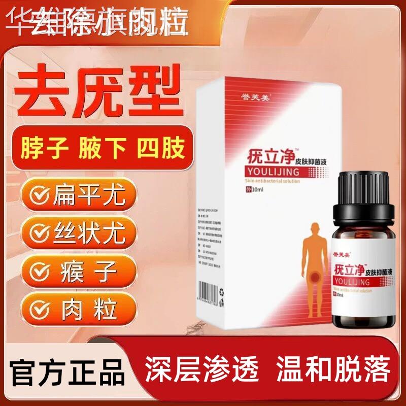 尤立净脖子腋下手背肉粒瘊子疙瘩丝状尤寻常跖尤温和祛扁平尤神器