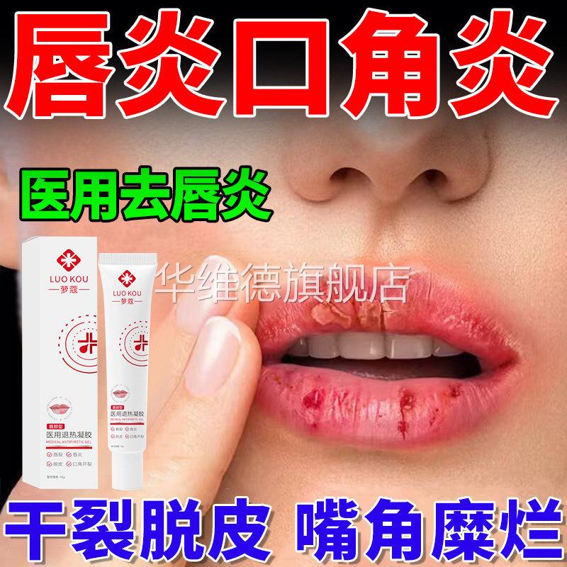 医用型唇膏治唇炎抗菌消炎儿童烂嘴唇起皮干裂脱皮润嘴角口角炎药