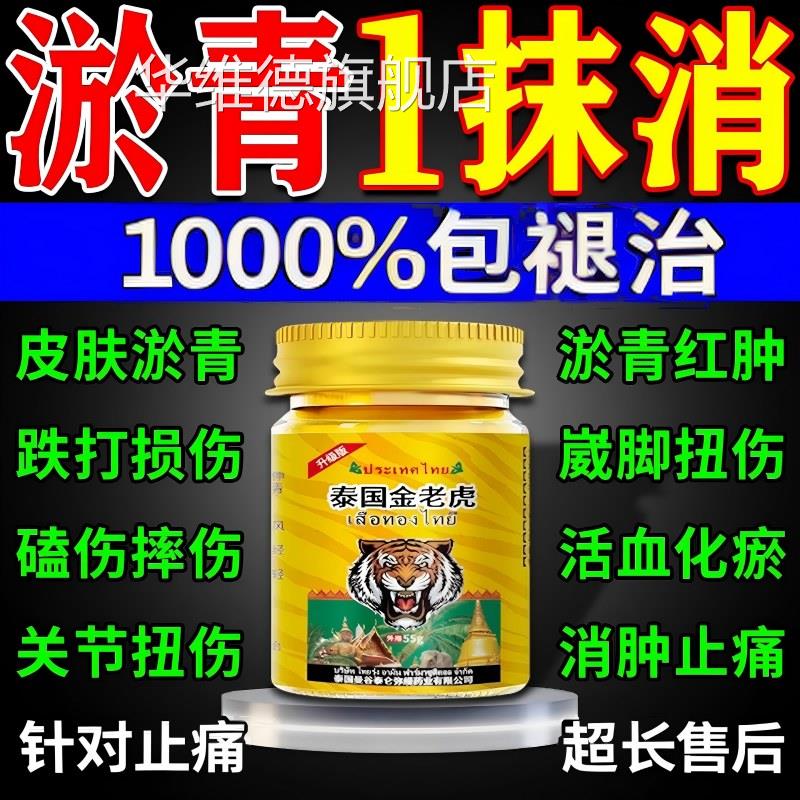 淤青膏快速扭消除儿童跌打损伤摔撞伤红肿专用发紫活血化瘀止痛消