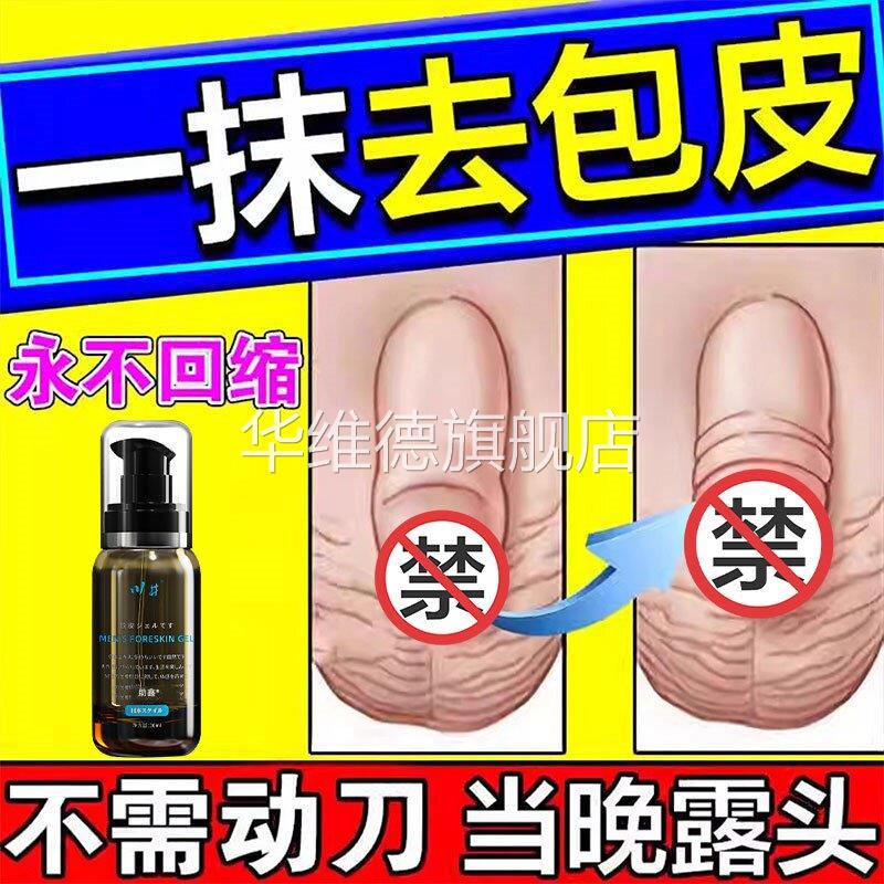 医用包皮外翻器自动脱落过长矫正器男用隐形阻覆环分离切除固定套