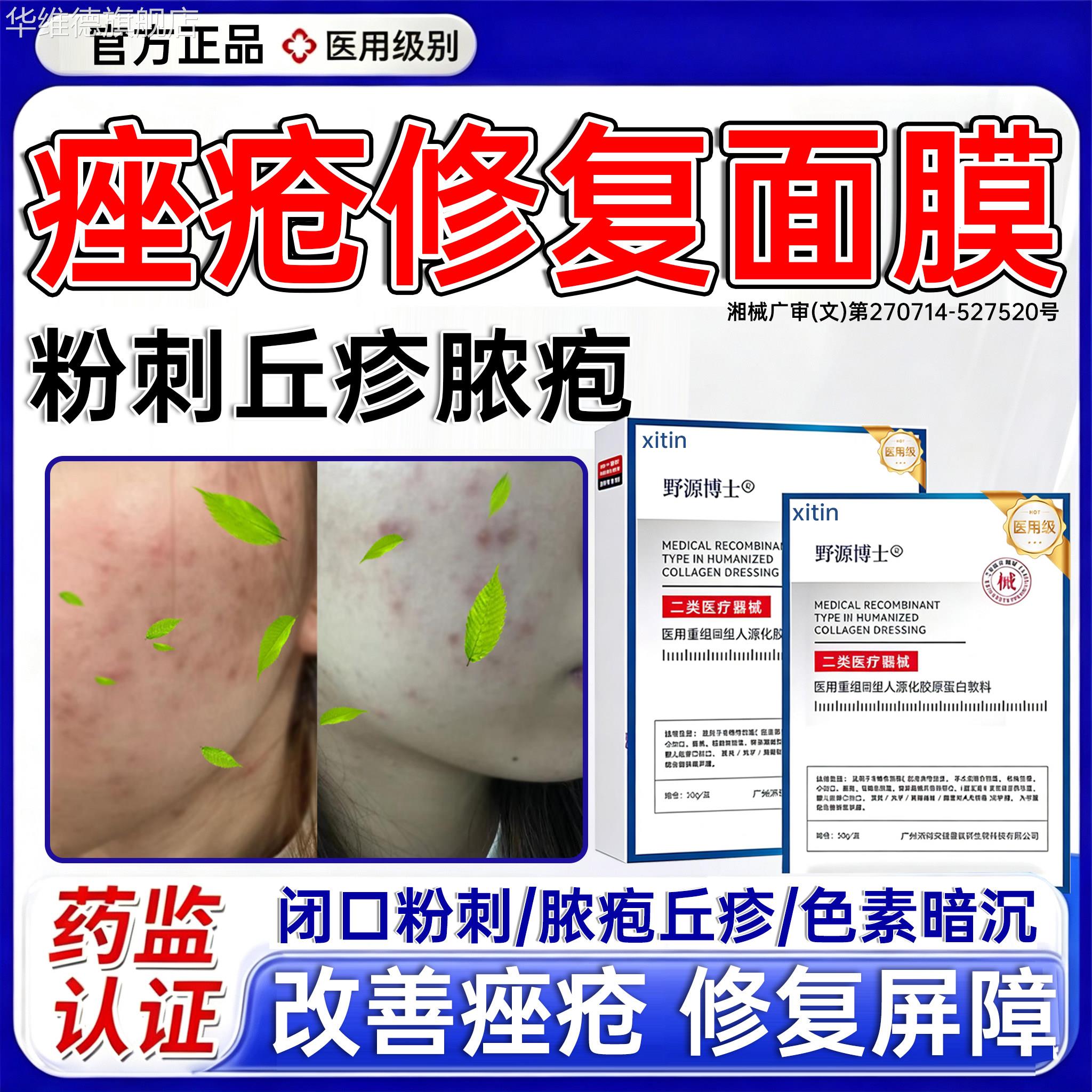 脸部痤疮医面膜用祛痘除玫瑰痤疮屏障痘痘修复消炎痘印毛囊炎PP华
