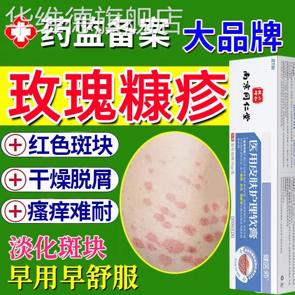 玫瑰糠疹专用软膏皮肤瘙痒红斑痤疮屏障修复红斑鳞屑皮炎湿疹UU华