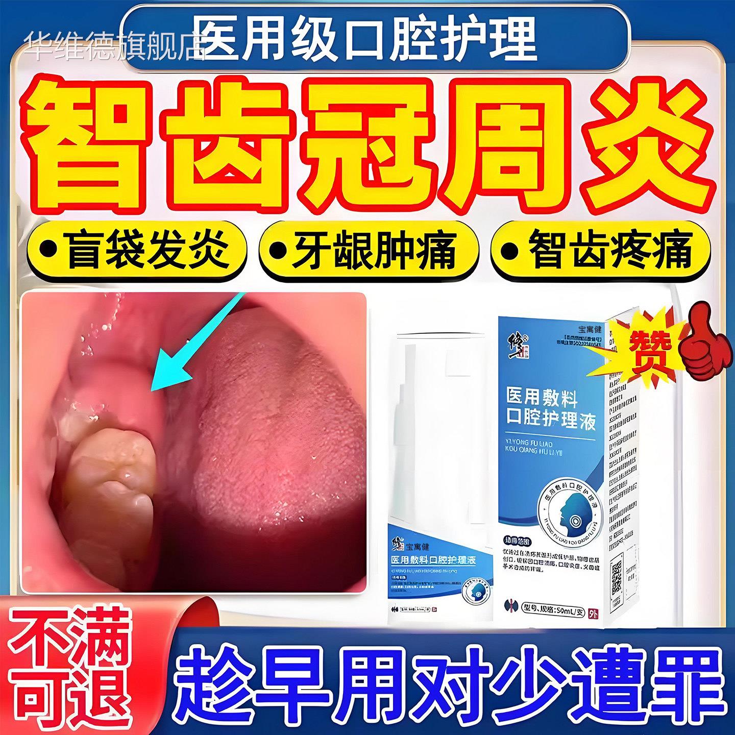 智齿冠周炎发炎漱口水牙龈牙药根上火消炎牙齿肿痛喷雾剂房同售华