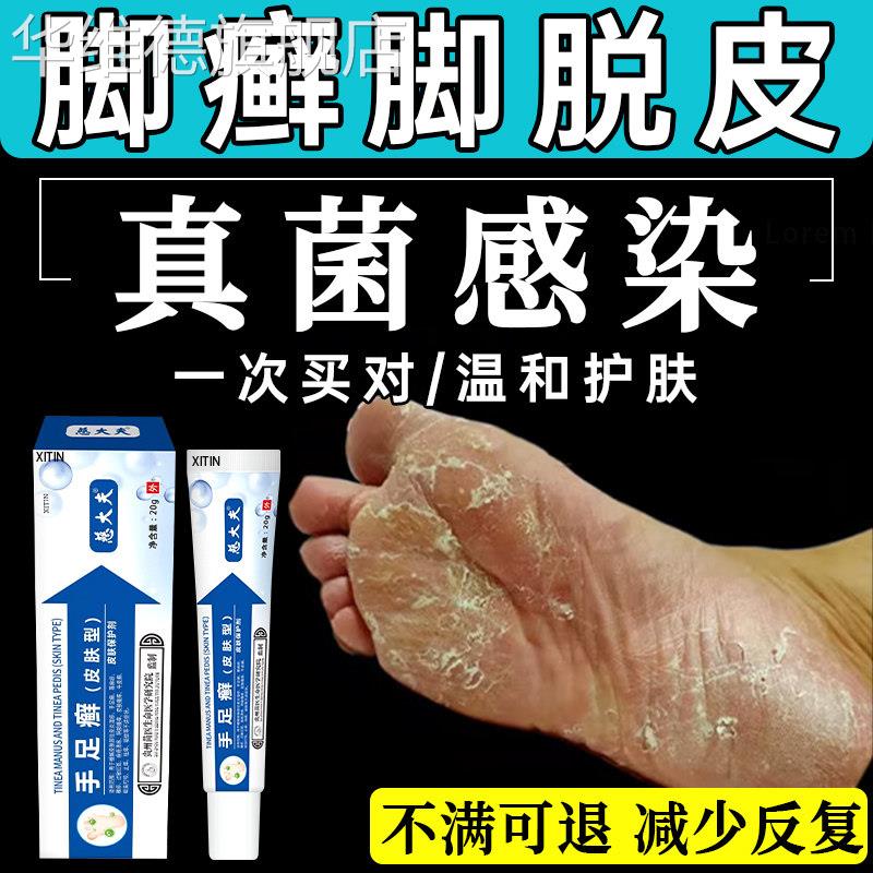 角化型足癣脚癣一次净官方旗舰店脚脱皮干裂真菌感染贵州神奇止UU