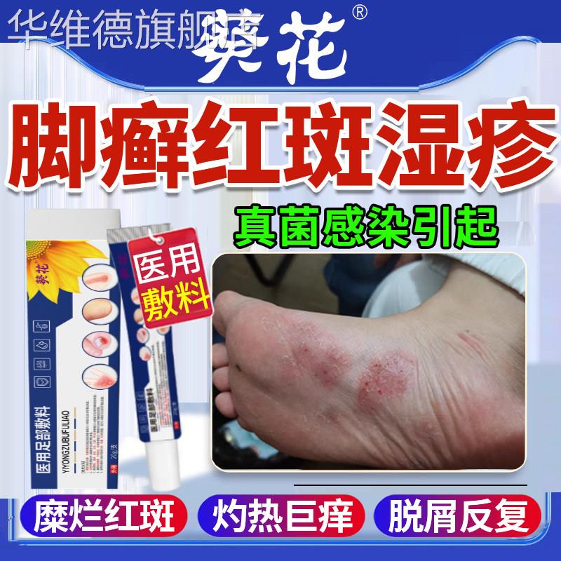 脚癣一次净真菌感染药膏止痒脚气正品喷雾脚部湿疹足藓官方旗舰店