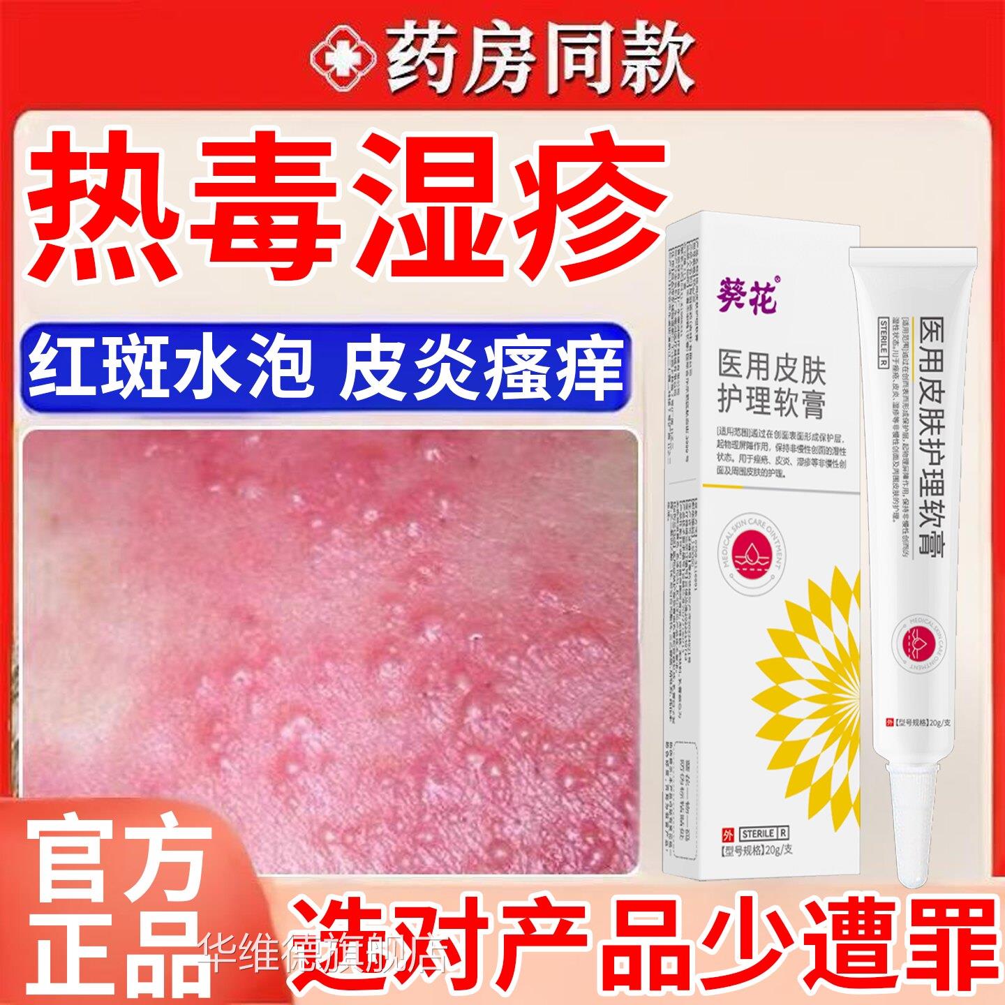 热毒湿疹止痒专用膏除湿皮皮肤一热就痒湿毒清软膏根湿痒炎水泡华