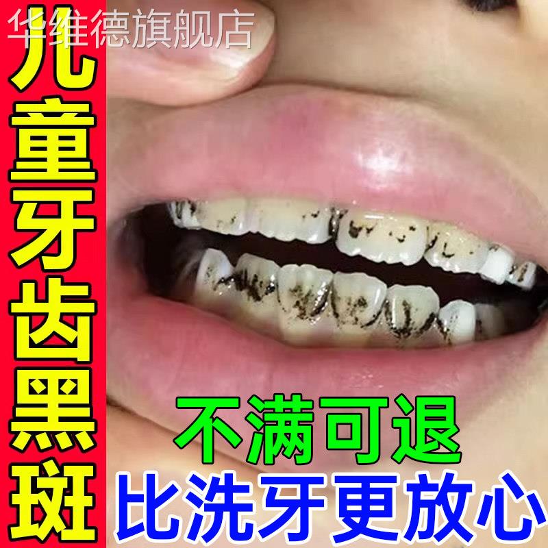 儿童牙齿黑色素沉淀去牙菌斑牙膏黑线 线黑斑黑渍污垢祛除神器美