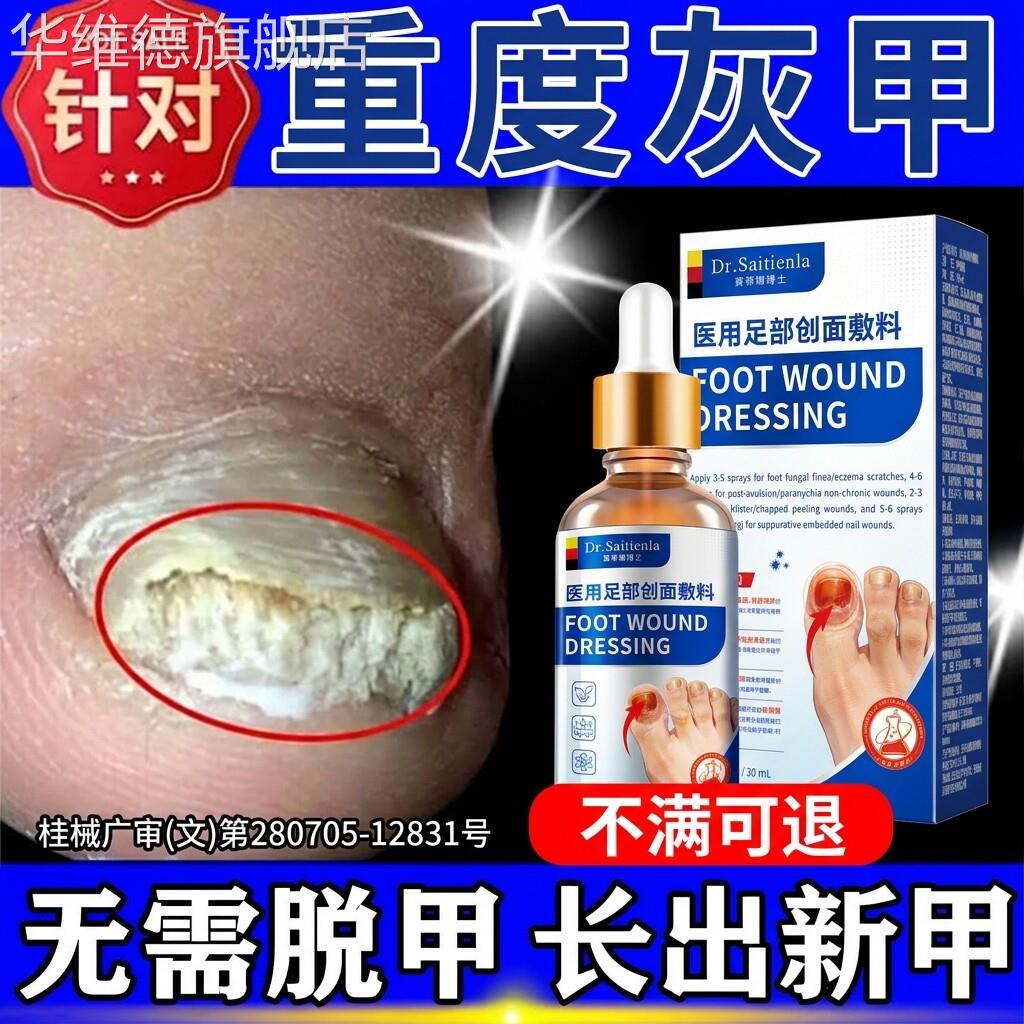 灰指甲脱甲膏脚指甲增厚发黄快速无痛脱甲精油凤仙花抑菌液软化剂