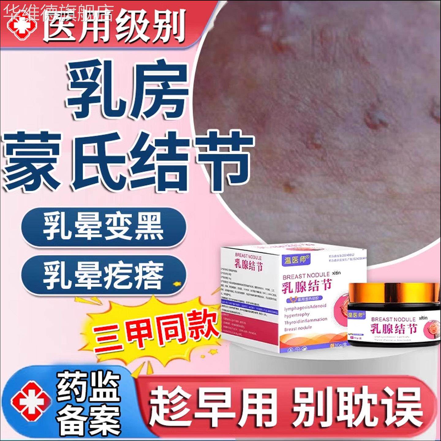 乳头颗粒乳房乳晕蒙氏结节小疙瘩发炎乳腺增生边缘凸起消除药膏TT