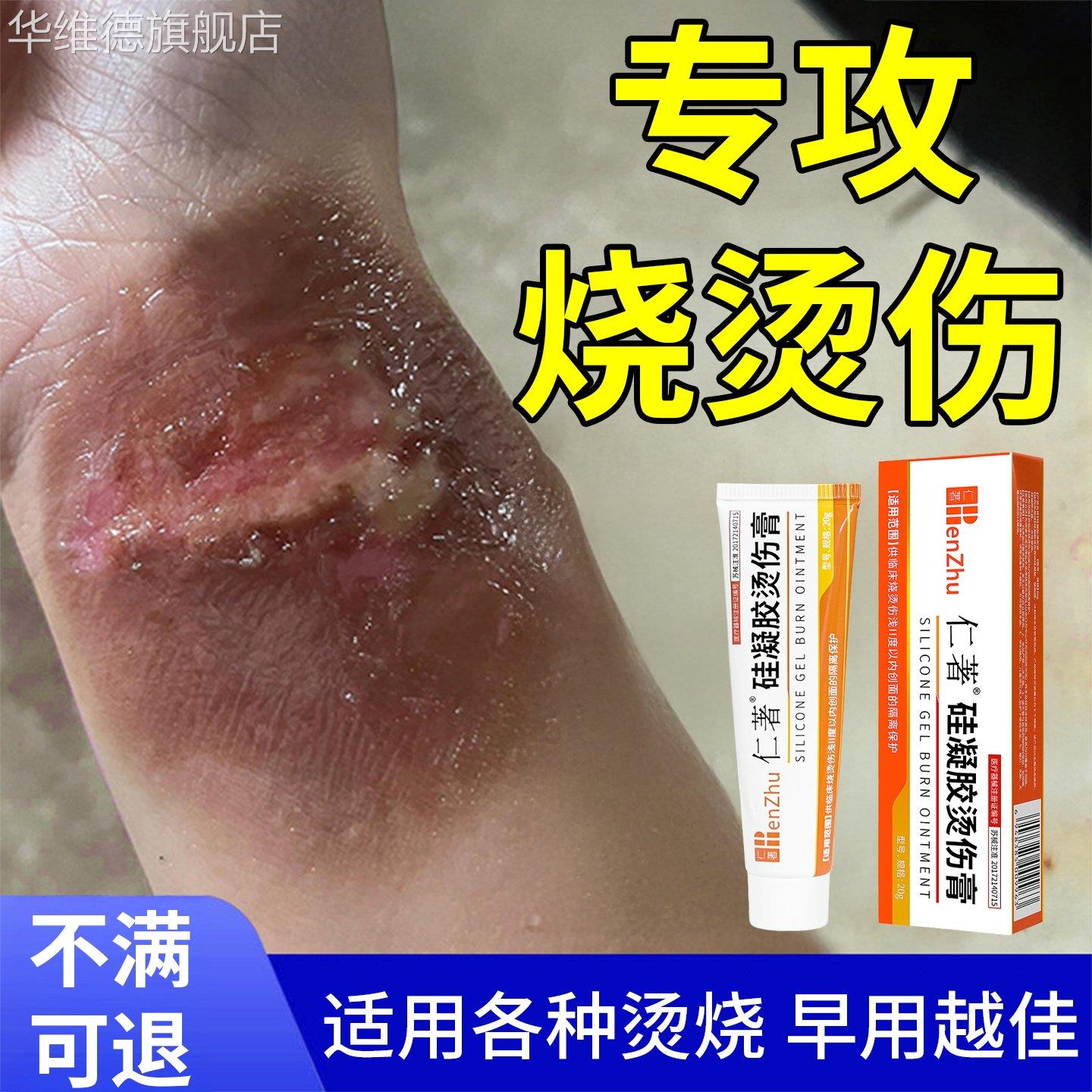 烫伤烧伤药膏修复快速愈合开水热油除疤不是低温湿润灼伤凝胶正品