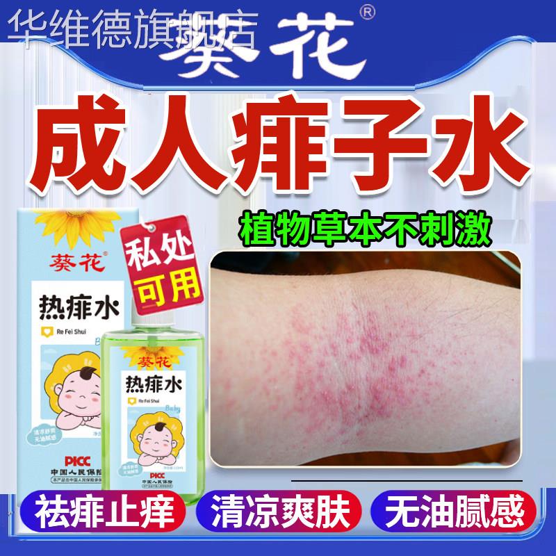 葵花痱子水成人专用止痒去痱大人防菲神器热痱水粉膏热疙瘩喷雾剂