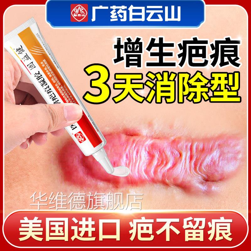 祛疤膏去疤增膏除疤痕生凸起去除疙瘩修复手术剖腹产医用硅酮凝胶