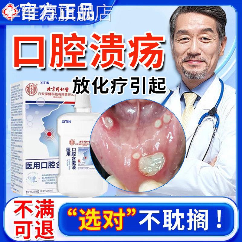 放疗化疗后用口腔溃疡口腔黏膜炎漱口水口舌干生疮疼痛人工唾液UU