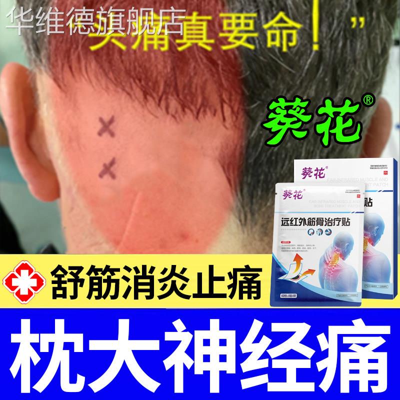 枕大神经痛贴炎症热敷性小颈椎压迫神经专用重度偏头痛后脑勺疼痛
