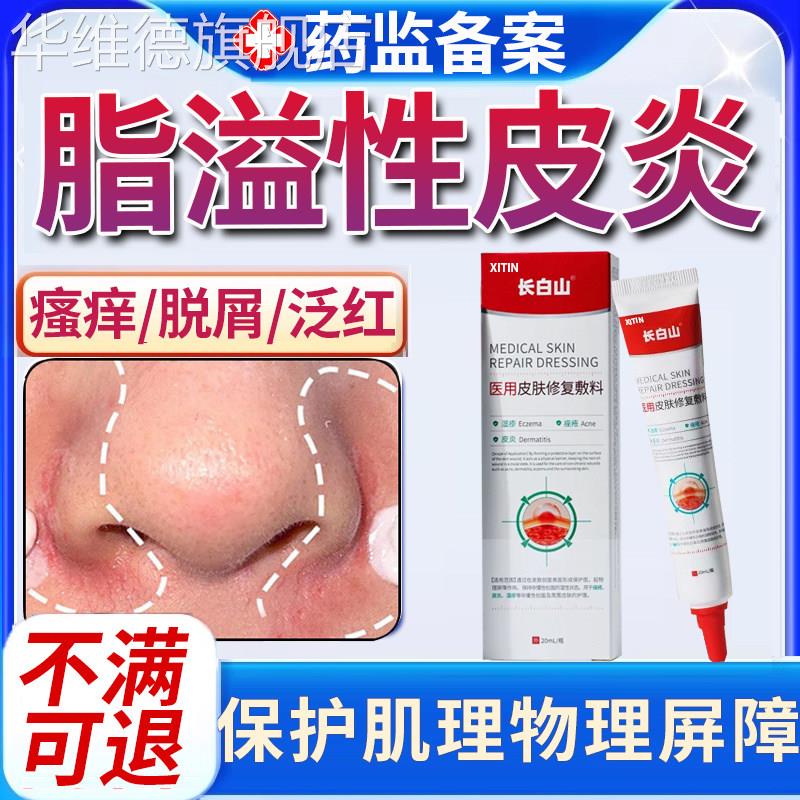 脂溢性皮炎面部护肤品马拉色菌鼻翼子两侧泛红脱皮干燥毛囊炎痘PP