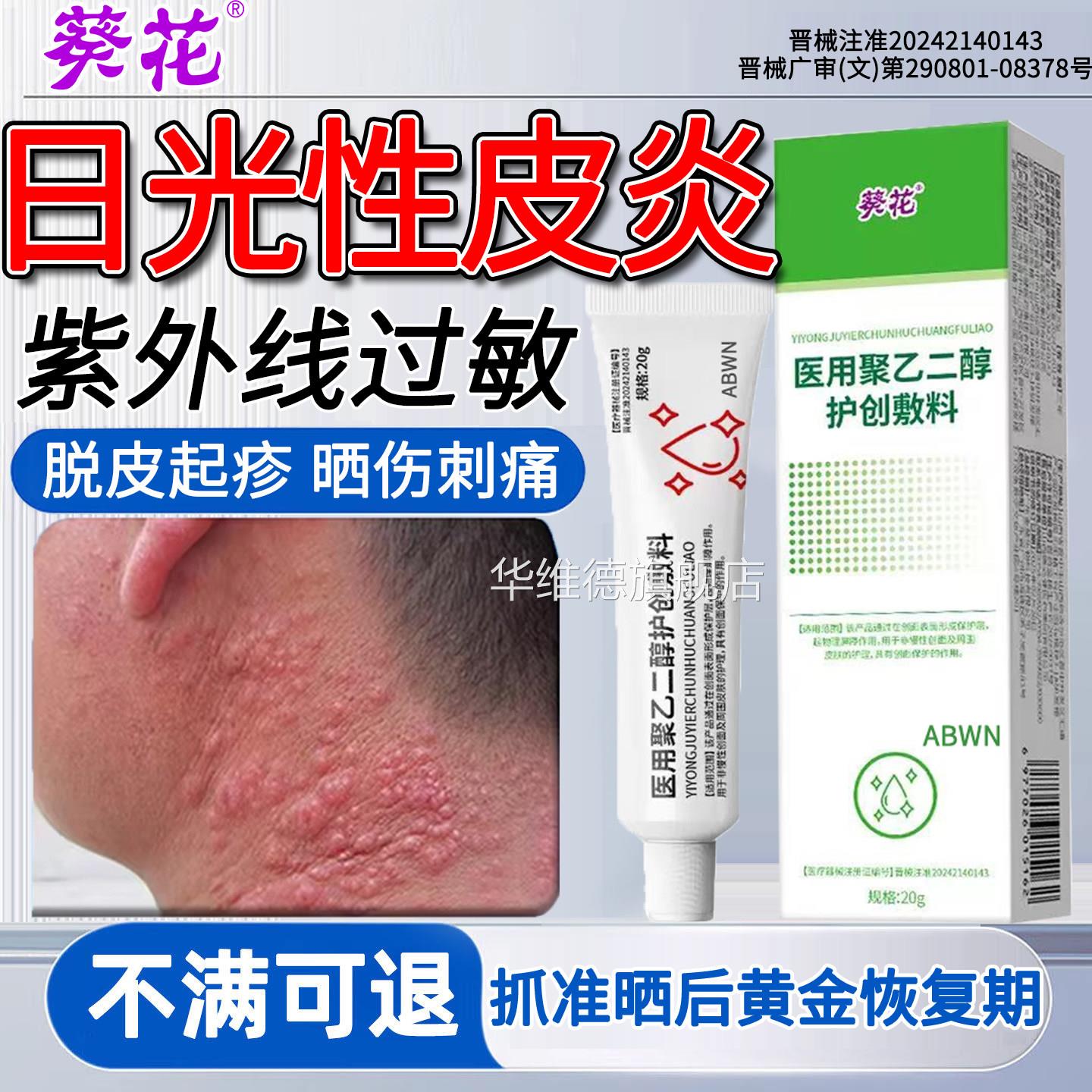 日光性皮炎紫外线过敏修复霜专膏干用晒伤特止瘙痒效药红肿燥起皮