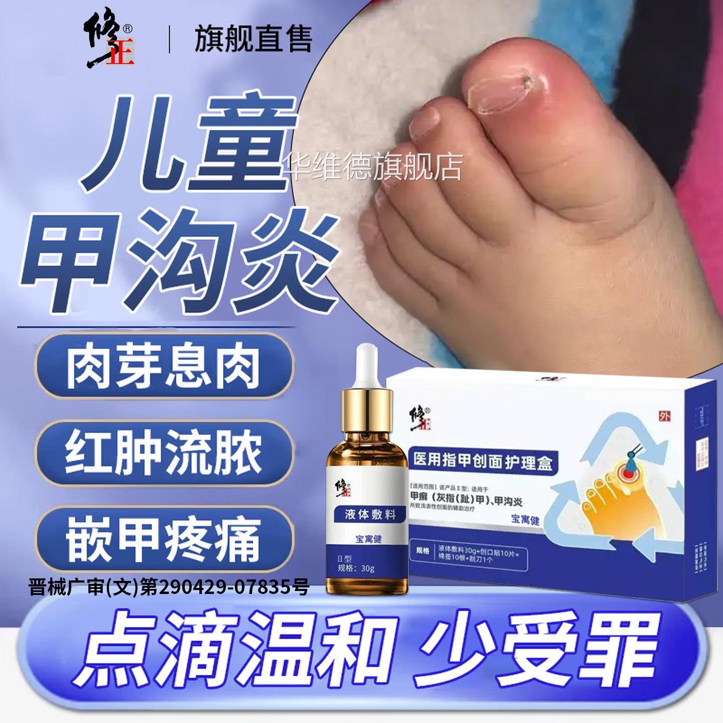 儿童甲沟炎息肉去除甲软化剂治灰甲专用特膏指神器效疗脚大拇指疼