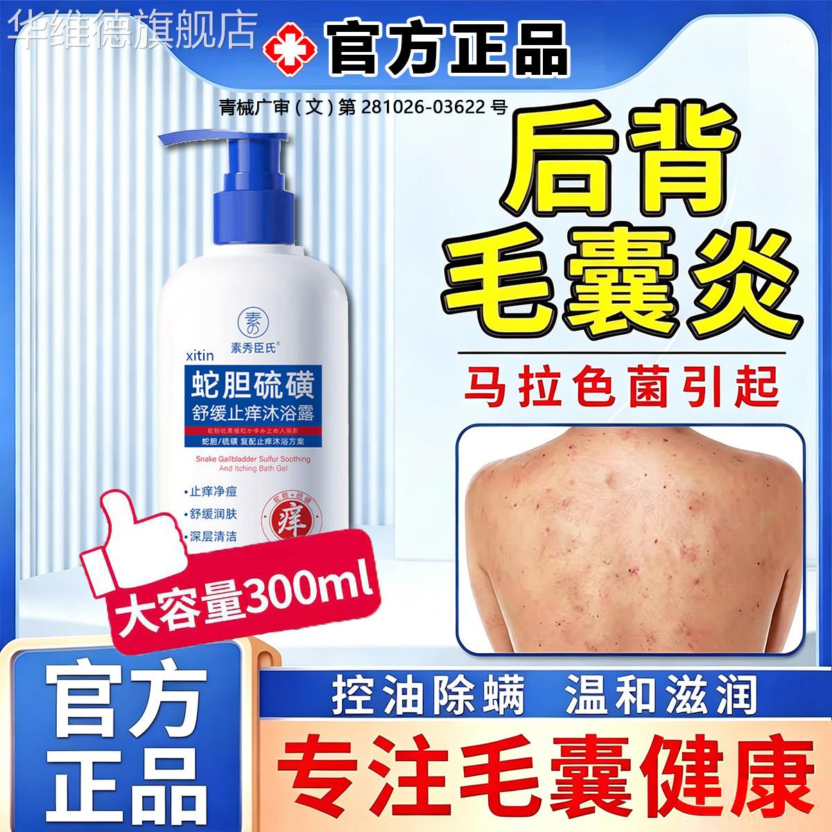 后背毛囊炎去除背上痘痘马拉色菌专用沐浴露医用除螨祛痘皮肤痒FY