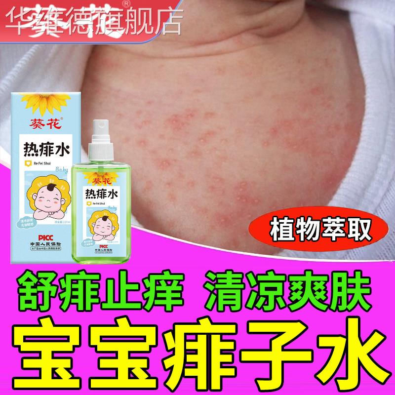葵花痱子水婴儿专用止痒去痱祛宝宝儿童热痱水长热疹淹脖子喷雾剂