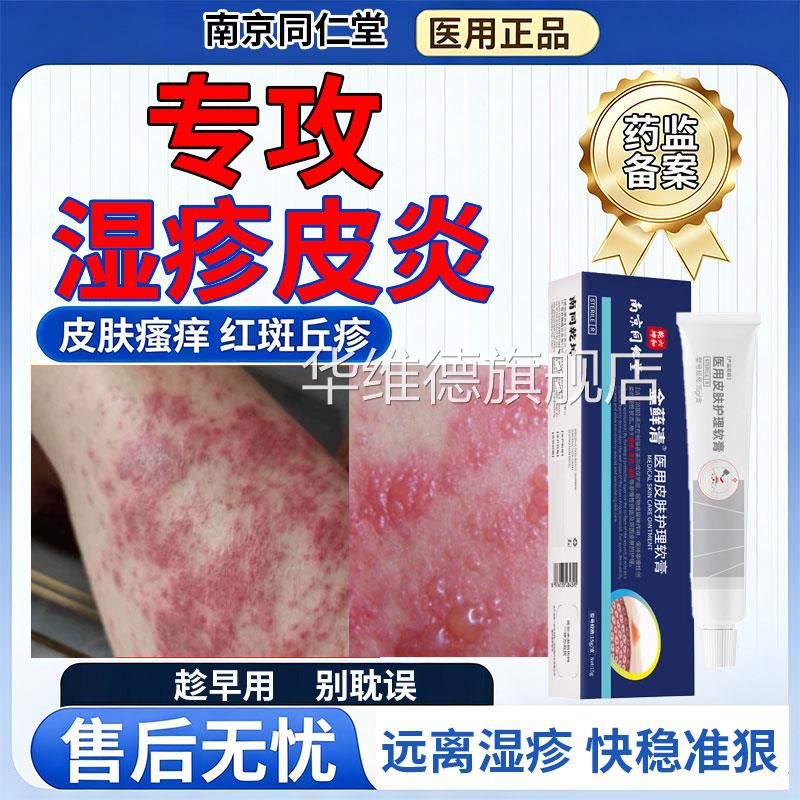 皮炎炎瘙痒湿止痒膏抗菌消角化型湿专用除湿止痒皮肤护理软膏华维