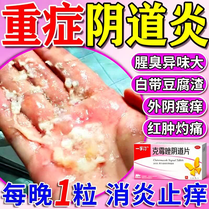 【一孚汀】克霉唑阴道片0.5g*1片/盒